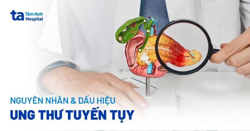 ung thư tuyến tụy