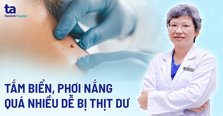 u mềm treo