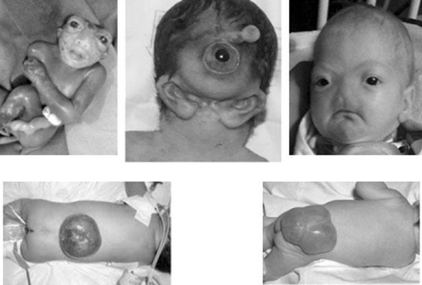 Tác hại “khủng khiếp” của hóa chất độc hại lên thai nhi - 1