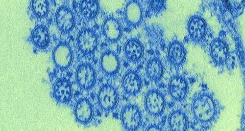 Hình ảnh virus cúm A gây bệnh ở người